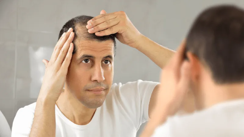 درمان‌های نوین ریزش مو