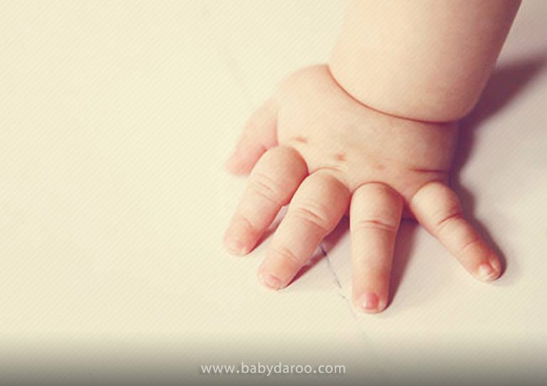 چند دلیل برای تورم دستان کودکان