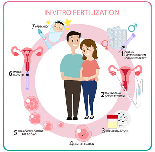 IVF چیست؟ مراحل ivf چند روز طول میکشد؟